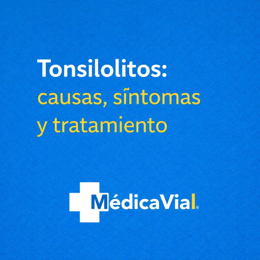 Tonsilolitos: causas, síntomas y tratamiento