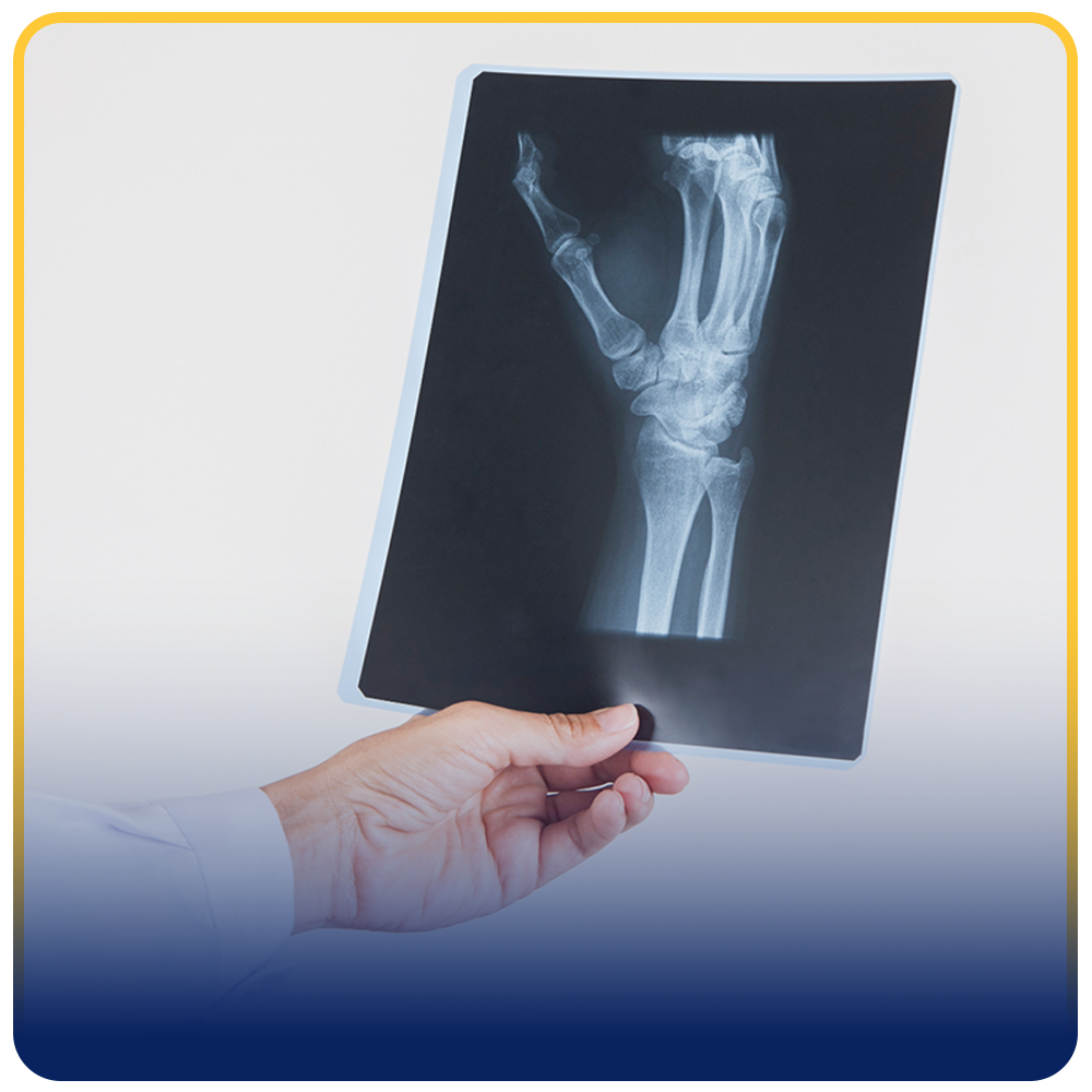 Proyección de Rayos X